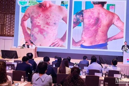 Các chuyên gia trình bày một ca bệnh lý về da với các đại biểu dự hội nghị