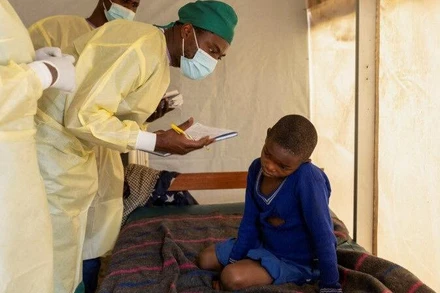 Các bác sĩ kiểm tra sự tiến triển của các tổn thương da của bệnh nhi mắc đậu mùa khỉ tại trung tâm điều trị ở Munigi, bắc Kivu, Cộng hòa dân chủ Congo, ngày 19/7/2024. (Ảnh: REUTERS) 