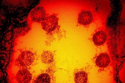 Ảnh vi điện tử được tăng cường màu chụp lại các hạt virus SARS-CoV-2 được phân lập từ mẫu bệnh phẩm của 1 bệnh nhân. (Ảnh: Viện Dị ứng và bệnh truyền nhiễm quốc gia Mỹ)