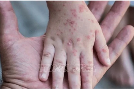 Ảnh minh họa: Reuters/TTXVN