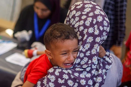 Em bé Palestine bị suy dinh dưỡng được điều trị tại một bệnh viện dã chiến ở Deir Al-Balah, phía nam Dải Gaza, ngày 22/6/2024. (Ảnh: Reuters) 