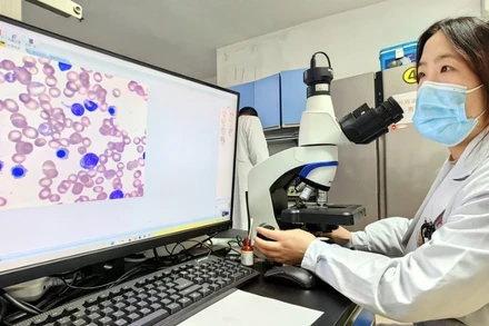 Một nhân viên xét nghiệm đang kiểm tra kết quả xét nghiệm tế bào máu do mô hình AI thực hiện tại Bệnh viện Tân Kiều thuộc Đại học Quân y ở Trùng Khánh, Trung Quốc, ngày 14/2/2023. (Ảnh minh họa: Bệnh viện cung cấp/Xinhua)