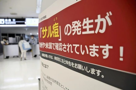 Áp phích cảnh báo du khách đề cao cảnh giác với các trường hợp mắc bệnh đậu mùa khỉ, đặt tại sân bay Narita, Nhật Bản. (Ảnh: Yomiuri Shimbun)