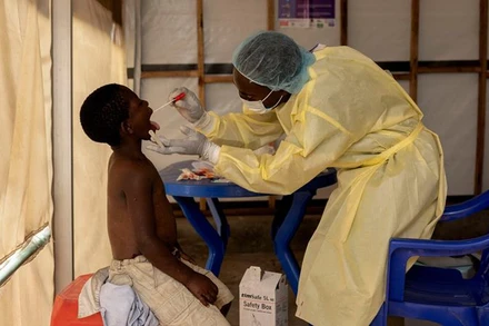 Lấy mẫu bệnh phẩm trên một ca bệnh nhi nghi nhiễm bệnh đậu mùa khỉ tại trung tâm điều trị ở Munigi, Bắc Kivu, Cộng hòa dân chủ Congo, ngày 19/7/2024. (Ảnh: Reuters)