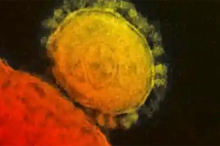 Phát hiện một ca dương tính với MERS tại Abu Dhabi