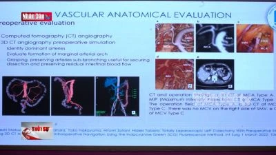 Hợp tác Việt - Pháp trong điều trị ung thư đại trực tràng