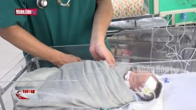 Cứu sống bé sơ sinh bị hoại tử ruột từ trong bụng mẹ