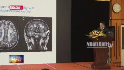 Kết hợp Đông - Tây y trong phòng chống đột quỵ não