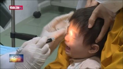 Bệnh mắt đỏ diễn biến phức tạp tại Bình Định