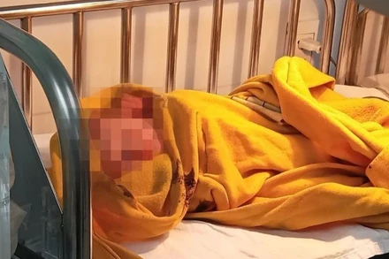 Bé gái sơ sinh đang được chăm sóc tại Bệnh viện Nhi đồng Đồng Nai.