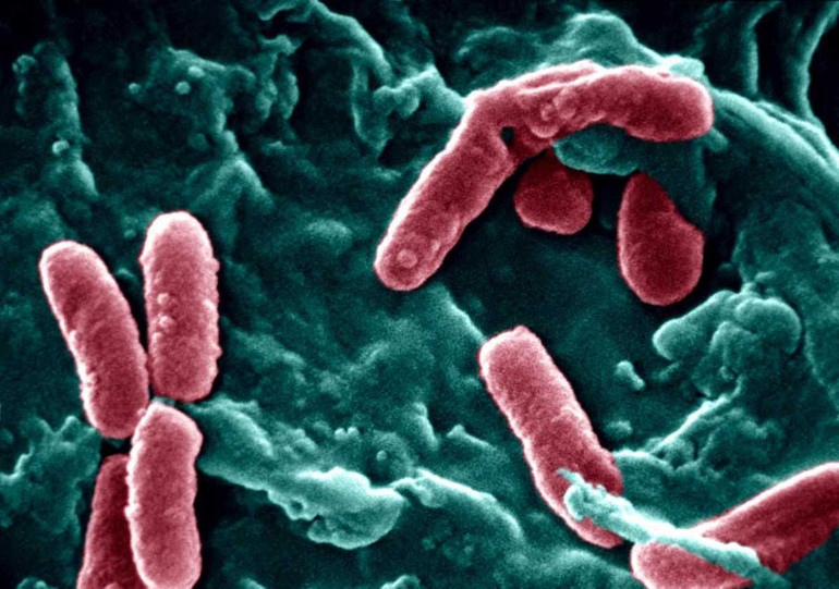 Chín loại vi khuẩn kháng kháng sinh nguy hiểm nhất ảnh 6