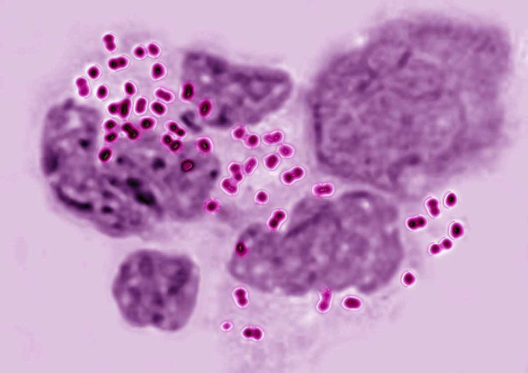 Chín loại vi khuẩn kháng kháng sinh nguy hiểm nhất ảnh 5