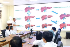 Phó Giáo sư, Tiến sĩ Dương Đức Hùng, Giám đốc Bệnh viện Hữu nghị Việt Đức cùng các bác sĩ hội chẩn trường hợp ghép tạng domino đặc biệt.