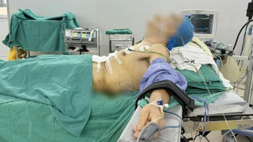 Tư thế nửa nằm nửa ngồi của bệnh nhân trong phòng phẫu thuật.
