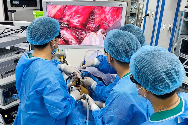 Ê-kíp bác sĩ Bệnh viện K phẫu thuật cho bệnh nhân ung thư thực quản phức tạp bằng phương pháp mổ nội soi 3D. 