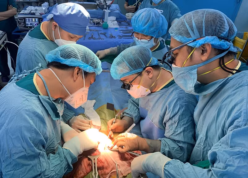 Các bác sĩ Bệnh viện Nhi đồng 2 Thành phố Hồ Chí Minh trong một ca ghép gan. 