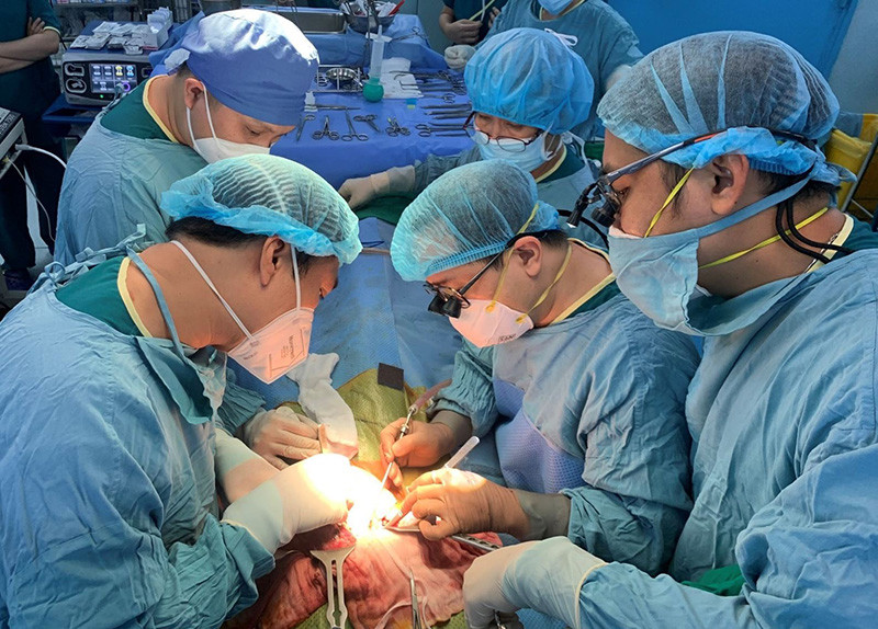 Các bác sĩ Bệnh viện Nhi đồng 2 Thành phố Hồ Chí Minh trong một ca ghép gan. 