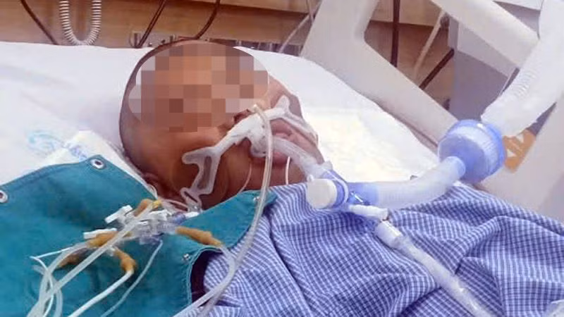 Bệnh nhân Sùng A Dương đang điều trị tại Bệnh viện Bạch Mai.