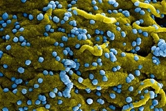WHO: Ethiopia tuyên bố khống chế được đợt bùng phát virus Marburg