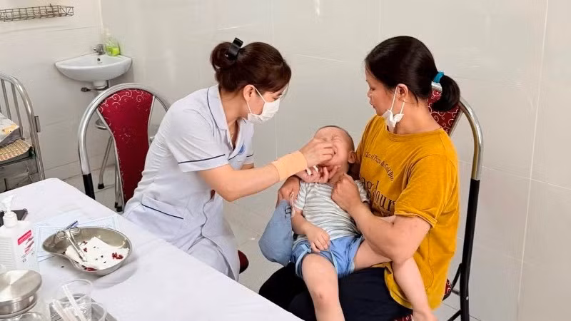 Cho trẻ uống Vitamine A tại tuyến y tế cơ sở.