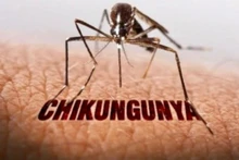 Muỗi vằn truyền bệnh Chikungunya. (Ảnh: SYT)