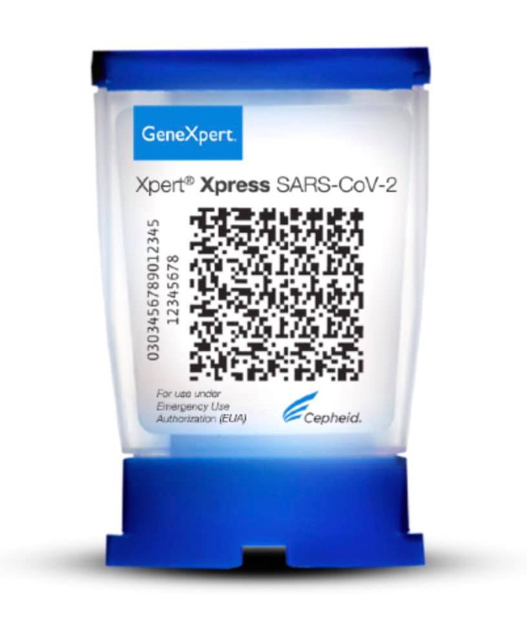 Thêm phương pháp xét nghiệm mới để tìm người nhiễm virus SARS-CoV-2 -0