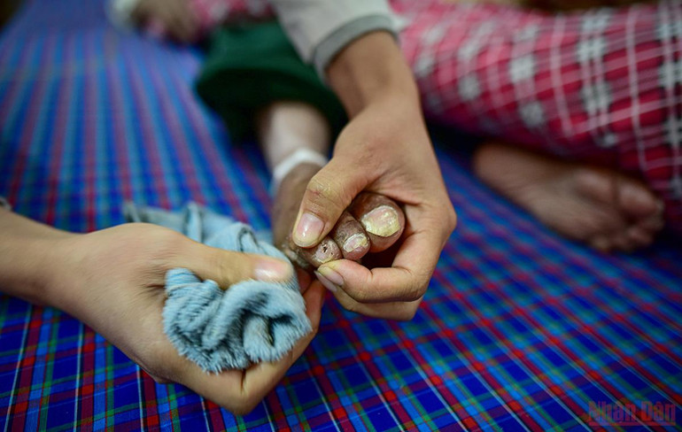 “Mối lương duyên” trong trung tâm điều dưỡng thương bệnh binh -0