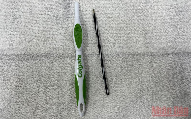 Phát hiện dị vật trong dạ dày. Nội soi lấy bàn chải đánh răng và ruột bút bi trong dạ dày -0