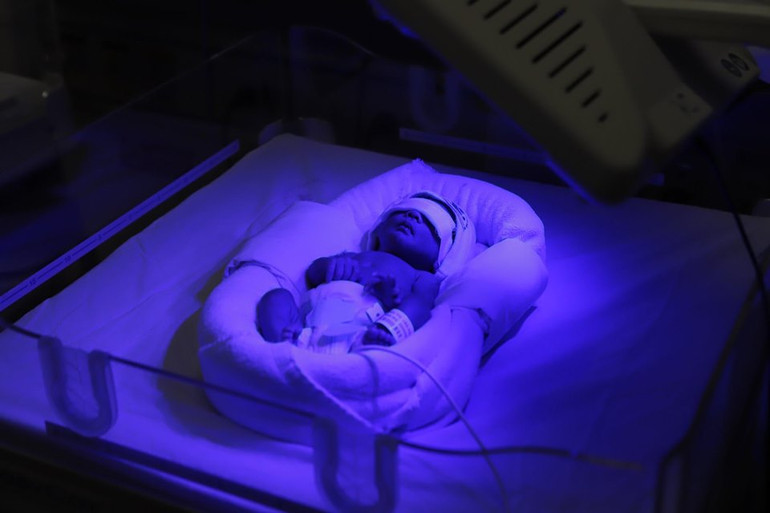 Bé trai vẫn đang được chiếu đèn do mắc vàng da sơ sinh. Hy hữu giữ thai nhi năm tuần trong bụng dù sản phụ đã vỡ tử cung -0