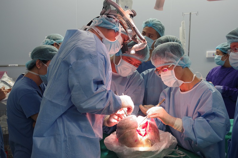 Các bác sĩ cân não trước ca ghép đa tạng. Lần đầu tiên ghép thành công đồng thời hai cẳng tay -0