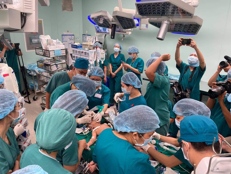 Ca phẫu thuật huy động ê-kíp 100 y, bác sĩ. tphcm_phau_thuat_tach_roi_hai_be-1609039853114.jpg