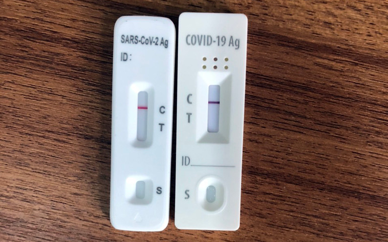 Test nhanh kém nhạy, người dân không nên chủ quan -0