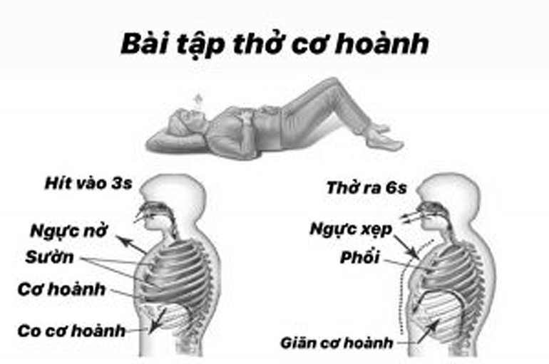 3 bài tập giảm khó thở rất cần thiết cho F0 chưa tới được bệnh viện -0