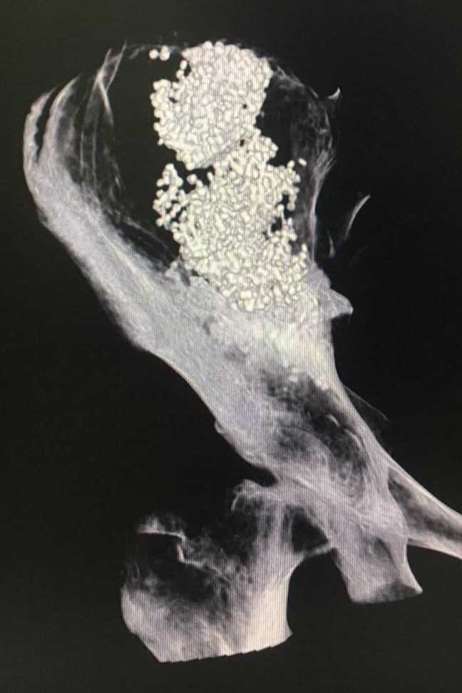 Không chủ quan với cơn đau xương chậu ở tuổi dậy thì -0