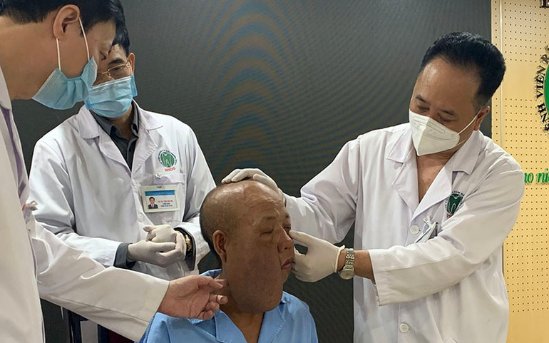Bệnh nhân được lên phương án phẫu thuật tốt nhất. Phẫu thuật cho người đàn ông có khối u kỳ dị trên mặt -0