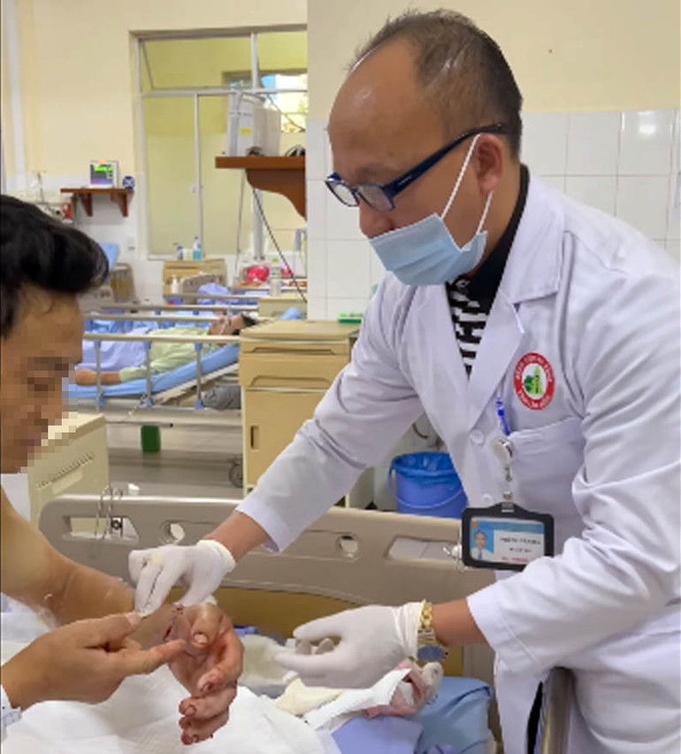 Nối thành công bàn tay bị cưa máy cắt rời -0