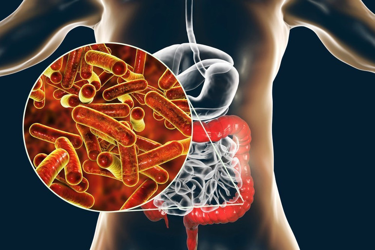 Nguyên nhân thường gặp nhất gây nôn và đau bụng ở trẻ em là viêm dạ dày-ruột cấp do virus như rotavirus, norovirus, calicivirus, adenovirus, Covid-19. Nhiều trẻ nôn trớ, đau bụng, chuyên gia chỉ cách xử trí -0