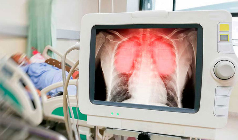 Nỗi sợ của những người Nga mắc Covid-19 nhiều lần -0