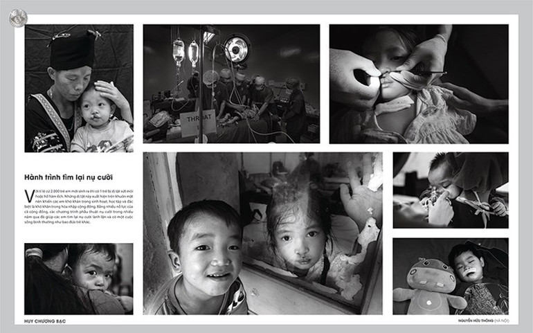 HCB “Hành trình tìm lại nụ cười” (Nguyễn Hữu Thông) - Huy chương bạc. Nhiều sáng tạo, thể nghiệm tại Festival Nhiếp ảnh trẻ 2021 -0