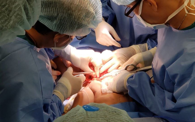 Tách thành công cặp song sinh Trúc Nhi - Diệu Nhi -0