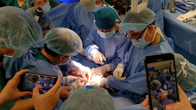 Tách thành công cặp song sinh Trúc Nhi - Diệu Nhi -1