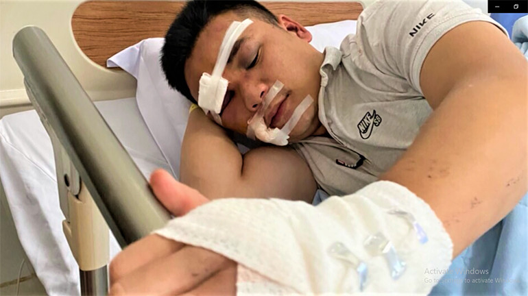 Bắt giam bốn đối tượng tấn công lực lượng Công an xã đang làm nhiệm vụ -0