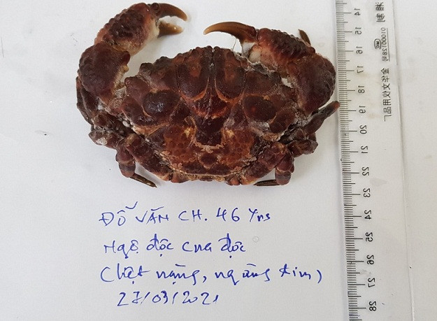 Ngộ độc nguy kịch do ăn cua mặt quỷ -0