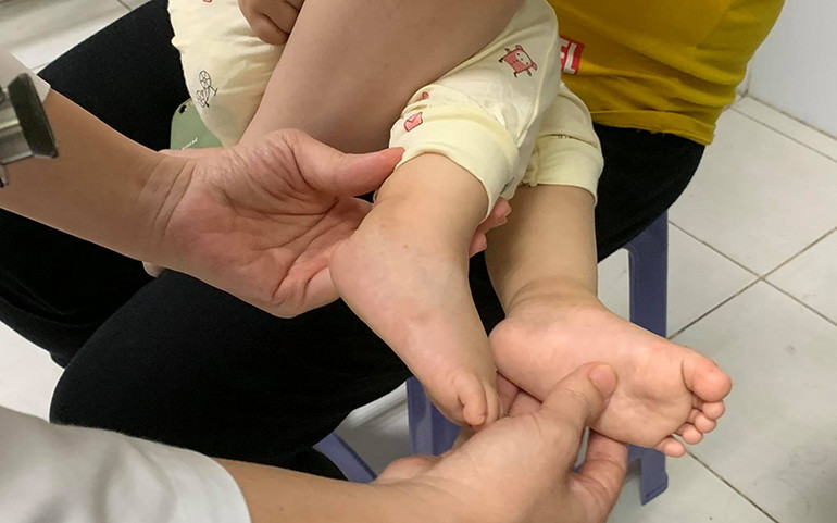 Số ca mắc tăng nhanh, cảnh giác trước mùa dịch tay chân miệng ảnh 3 Số ca mắc tăng nhanh, cảnh giác trước mùa dịch tay chân miệng -0