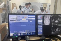 Bệnh viện Bạch Mai là cơ sở y tế đầu tiên được phê duyệt giá dịch vụ chẩn đoán hình ảnh không in phim. 