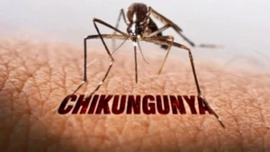 Muỗi vằn truyền bệnh Chikungunya. (Ảnh: SYT)