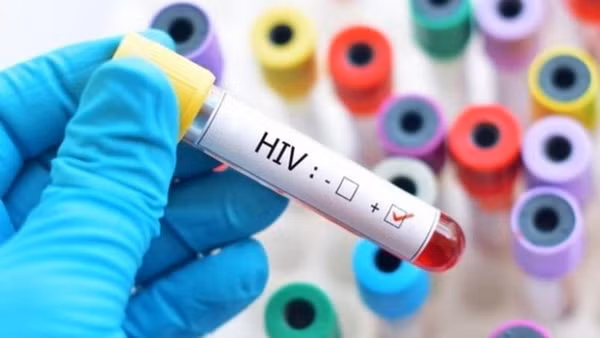 Sửa quy định về cấp giấy chứng nhận bị phơi nhiễm với HIV, bị nhiễm HIV do tai nạn rủi ro nghề nghiệp. (Ảnh minh họa)