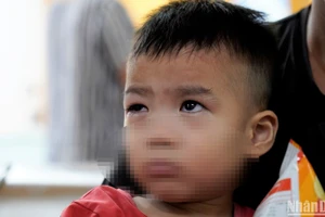 Trẻ đau mắt đỏ khám tại Bệnh viện Mắt Trung ương. (Ảnh: THẾ KHẢI)