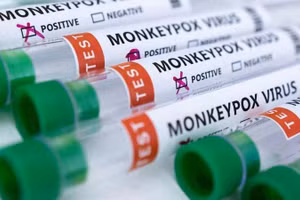 Ống đựng mẫu bệnh phẩm dương tính với đậu mùa khỉ. (Ảnh: Reuters)