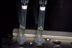 Hai mẫu bệnh phẩm nghi ngờ nhiễm virus đậu mùa khỉ đang trong quá trình xét nghiệm tại phòng thí nghiệm vi sinh, Bệnh viện La Paz, Madrid, Tây Ban Nha, ngày 1/6/2022. (Ảnh: Reuters)